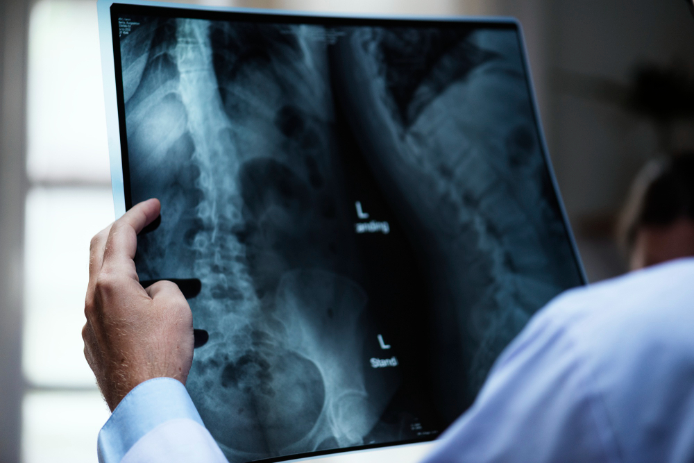 X-Rays in Wenatchee